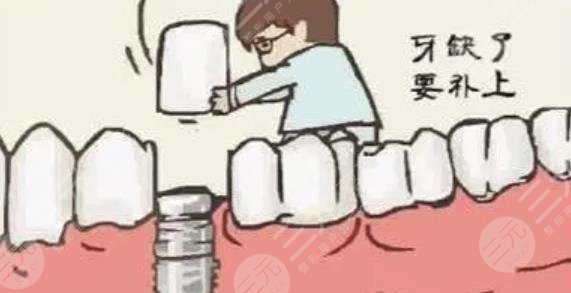 牙齿种植