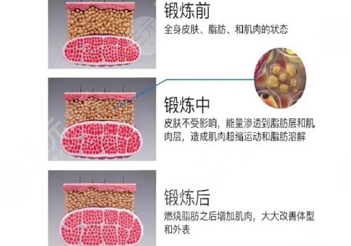 美修斯减肥有用吗?