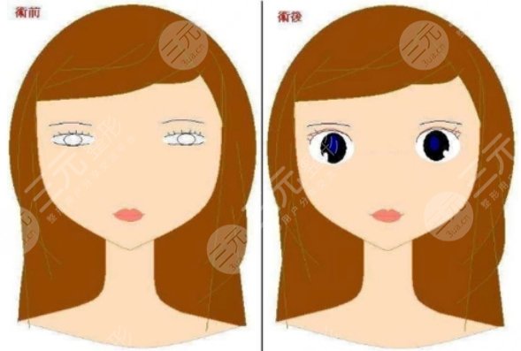 朴相根双眼皮修复怎么样有案例吗