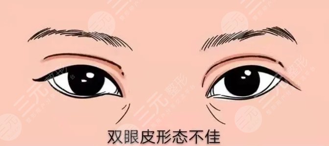 吴小蔚双眼皮修复案例分享！武汉人气整形医生资料&点评更新~