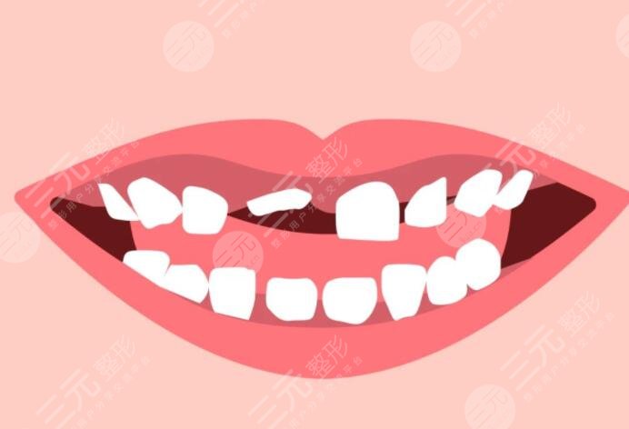 牙科私人贵还是医院贵?一个牙医的良心忠告医院怎么选?只选对的不选贵的~