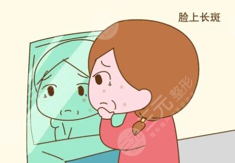 激光祛斑20天变化图片