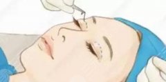 割双眼皮多少钱2023价格表更新！附3家口碑医美介绍~