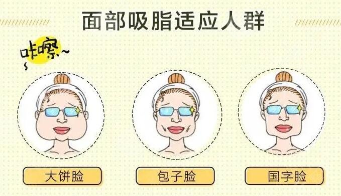 面颊吸脂要戴多久的头套?