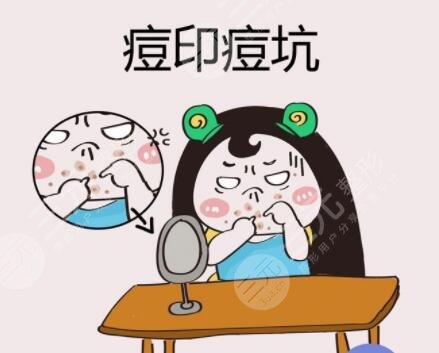 激光去痘坑