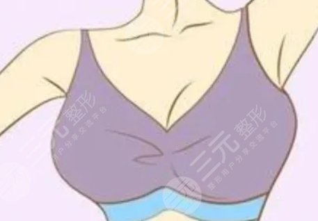 丰胸产品真的有用吗