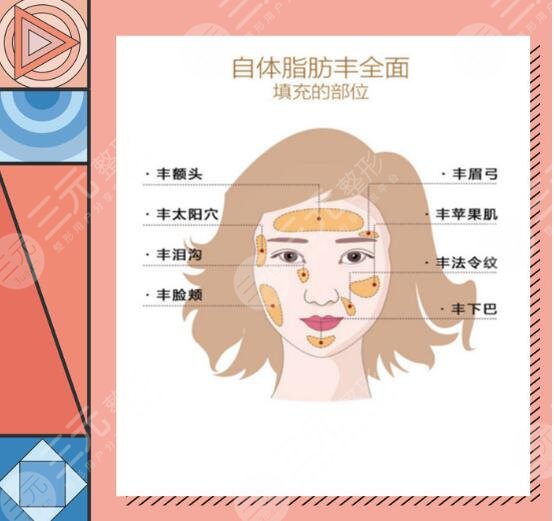 自体脂肪填充
