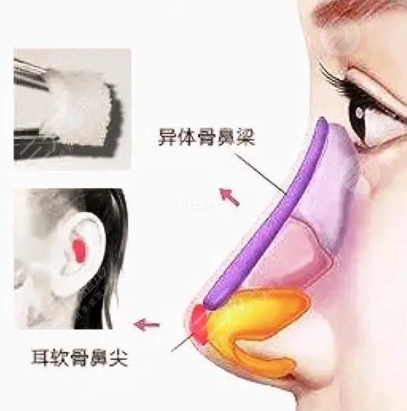 整形科擅长科普信息