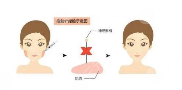 怎么让下颌缘紧致?