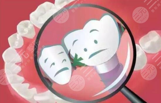 植一颗大牙多少钱一颗？具体价格影响因素都告诉你了！不交智商税~