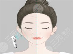 注射水光补水全过程解析 注射水光补水全过程解析