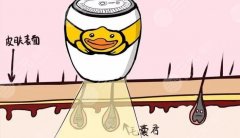 发际线后移好不好，果怎么样多少钱