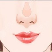 隆鼻整形手术感染怎么办 隆鼻整形手术感染怎么办