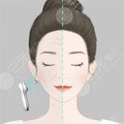 这四个微整形项目可以让你从此美美哒 这四个微整形项目可以让你从此美美哒