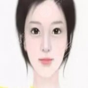 玻尿酸丰下巴果好不好,降低风险吗 玻尿酸丰下巴果好不好,降低风险吗