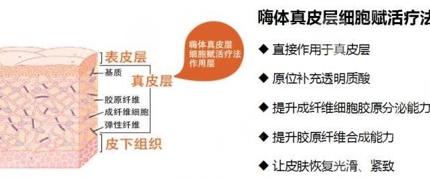 嗨体去颈纹
