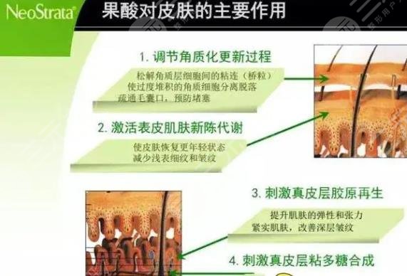 果酸嫩肤动漫