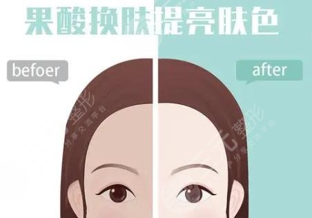 果酸嫩肤动漫