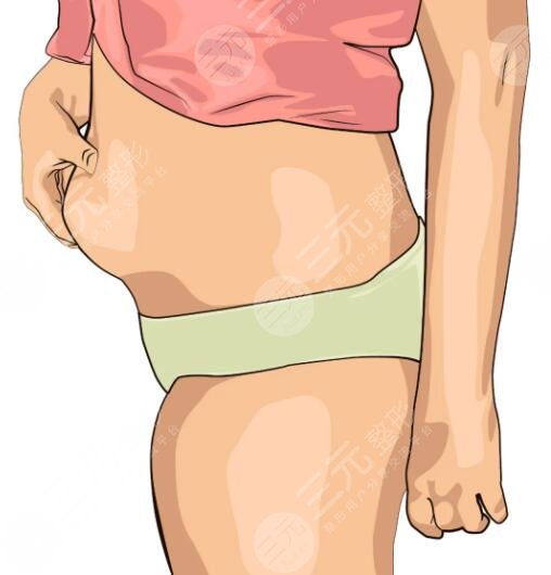 腹部吸脂减肥手术后要注意的问题