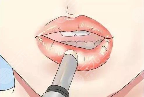 嘴唇上长水泡是什么原因?该如何护理?知识科普 注意事项,美肤干货!