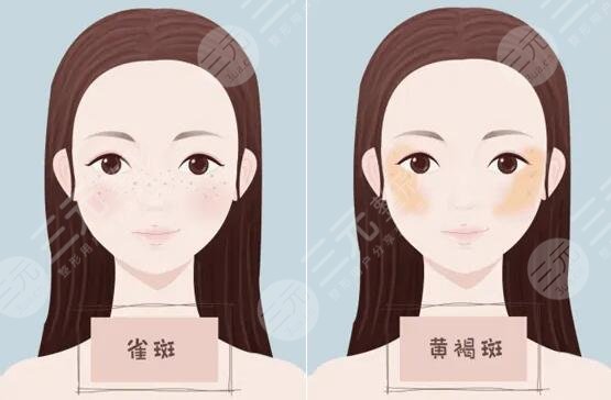 光明人民医院有激光去斑吗?多少钱?