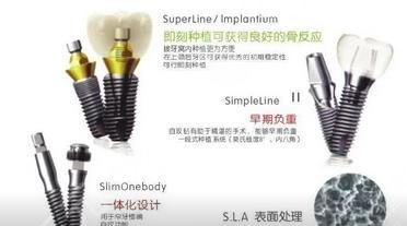 东莞康华医院口腔科种植牙案例