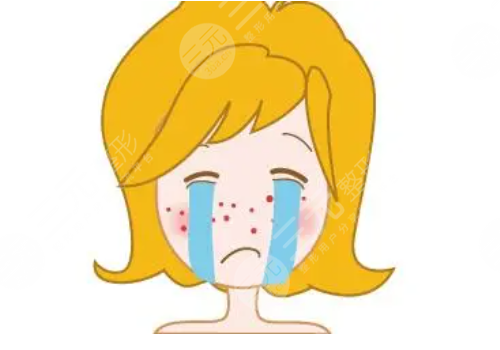 e光祛痘多少钱一次？