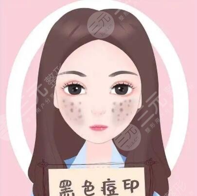 杭州浙二院缓解痘痘案例分享