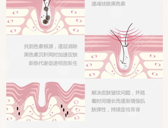 协和深?圳医院激光美容咋样?