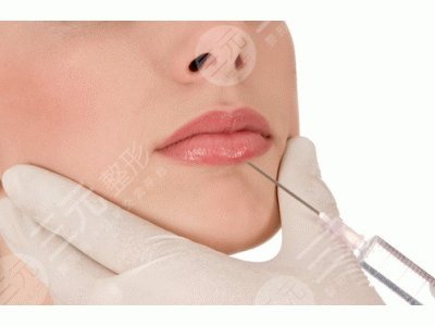 广州华美医疗美容医院M唇案例分享