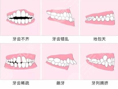 梅州人民医院热门项目