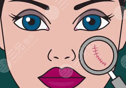 三,八大处疤痕修复专家擅长项目