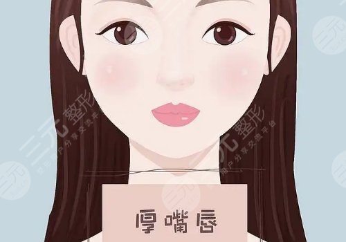 厚唇变薄手术多少钱？
