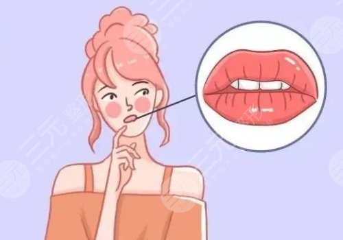 厚唇变薄手术多少钱？