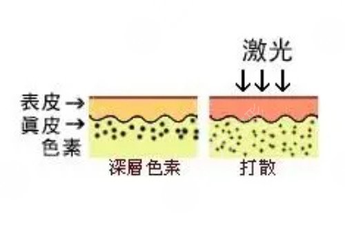 快速变白的方法有哪些?