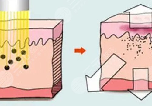 快速变白的方法有哪些?