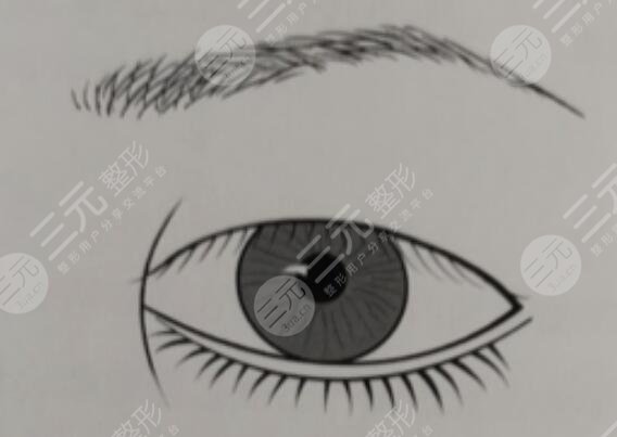 开眼角