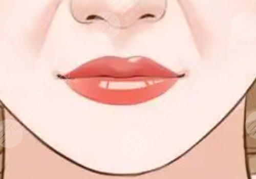 厚嘴唇怎么变薄？