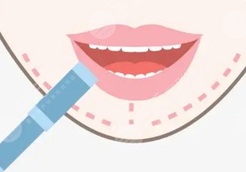 厚嘴唇怎么变薄？