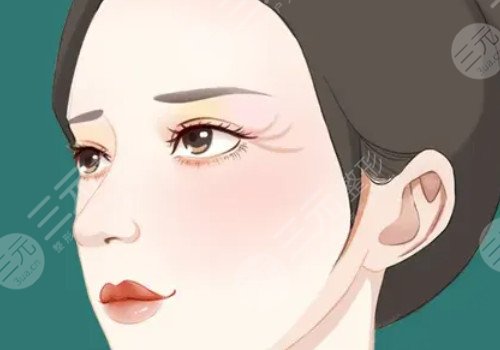 怎么去眼角纹有?