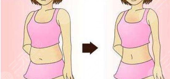 瘦肚子