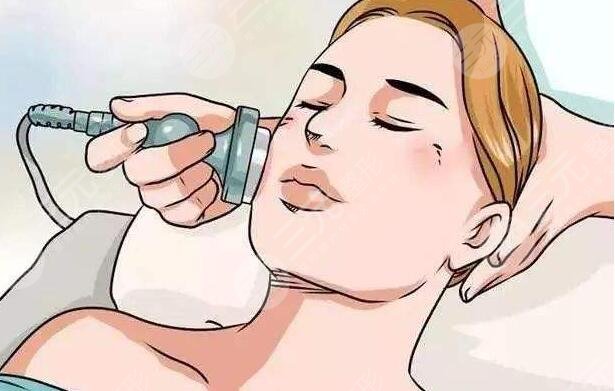 激光美白注意事项有那些?