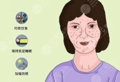 e光祛斑价格是多少钱？e光祛斑技术原理、实际果、价格收费影响因素~