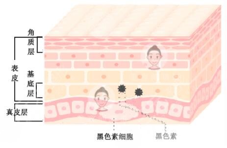 e光祛斑的原理是什么?