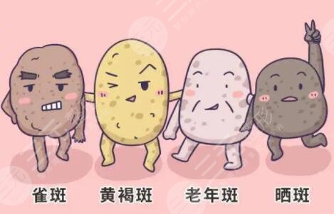 在进行e光祛斑的过程中需要注意的事项有哪些?