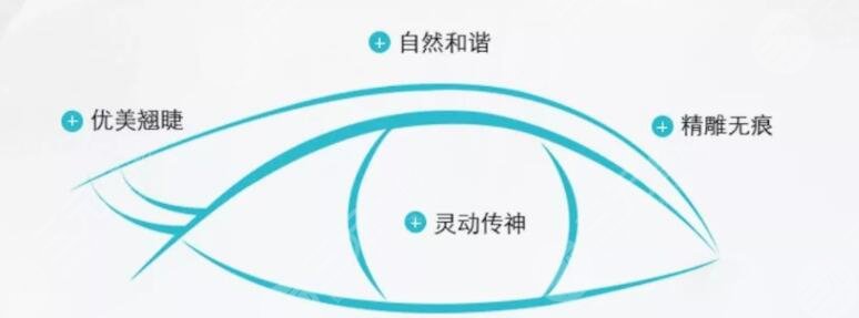 埋线双眼皮