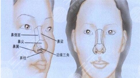 鼻整形修复