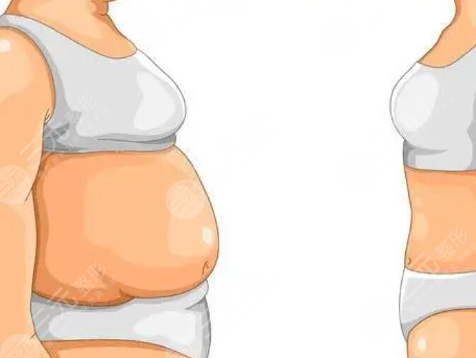 减肥的注意事项