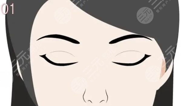 双眼皮缝线手术