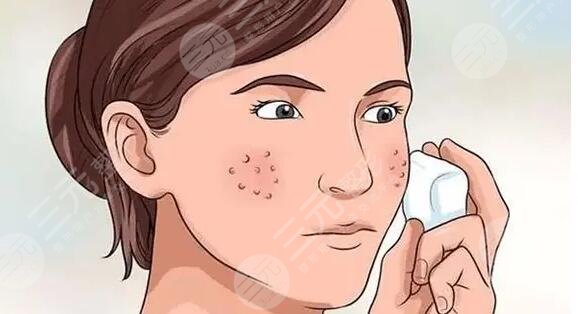 　　皮肤毛孔大怎么办?毛孔粗大看起来是一个很轻松的问题，但其实也属于皮肤问题之一，首先从外部条件来看，毛孔粗大会影响我们的外部美观性，其次毛孔粗大往往会伴随着油脂分泌过旺的情况出现，对于小伙伴们来说皮肤有所改良了之后就会适当缓解粗大的问题，当然在解决毛孔粗大问题的前提下，一定要先判断毛孔粗大的导致原因是什么?其次再来选择自己适合的方法下面的几种，解决毛孔粗大的方法是近年来大家都喜欢选择的手段之一，各位小伙伴们可以参考一下哦!  　　皮肤毛孔大怎么办?  　　1、毛孔粗大可以采用微针缓解方式，微针缓解方式主要采用的是专门的微针仪器，在皮肤上面做疏通，将营养物质输送到皮肤深层刺来，让皮肤达到快速再生的果，从而改良皮肤毛孔粗大的情况。  　　2、激光缓解，激光缓解也是毛孔粗大解决方法之一，能用特定的激光设备设施，在粗大毛孔领域进行照射，利用强脉冲激光等来到一定的收缩毛孔果，当然激光收缩毛孔对于医生和医院的硬件实力比较考验。  　　3、果酸换肤，主要是指在皮肤面部涂抹相对应的果酸来，让皮肤达到一个紧致的果，它可以在一定程度上改变皮肤的油脂分泌，让其达到一个比较平衡的状态。  　　4、，也是改良毛孔大的一个技术手段，能够让皮肤达到一个水润保湿的果，同理，是改良油脂分泌平衡，使皮肤清澈干净，减少毛孔粗大的情况。  　　5、当然除了上方的医美技术手段以外，想要改良毛孔粗大的问题其实也可以在日常生活中去下手，首先在清洁方面就要做到早晚两次清洁，皮肤可以用清洁力度相对比较强的洗面奶清洁，让皮肤拥有干净的呼吸环境，除此之外还可以使用控油的水乳和收缩毛孔的精华液。在生活作息上面就要改正不良的作息，争取做到早睡早起，不熬夜，多吃新鲜水果，减少辛辣刺激性食物的摄入量，多喝热水，少化妆，保持皮肤的清洁干净，在一定程度上缓解毛孔粗大的情况。  　　6、如果在夏天想改良皮肤毛孔大的话，也可以适当的采用冷敷的方法，用冷水敷脸，将毛巾沾取冷水放在脸部敷一段时间，可以让毛孔达到收缩的果，同时还可以提拉皮肤，减少油脂的分泌。  　　7、面膜也是比较耗费时间和精力的一个护肤手段，但是也可以在一定程度上减轻毛孔粗大症状，尤其在冬天，面膜有一定的冷服果，除了收缩毛孔以外，还可以补水保湿，在一定程度上改良毛孔粗大。  　　8、毛孔粗大，主要是油脂分泌不平衡造成的，所以需要多补水，不管是面膜还是补水水乳，又或者是精华，这些都是需要归纳到日常生活中的，皮肤的含水量达到了标准，那么就可以改良毛孔粗大的问题。  　　上次被许多毛孔粗大求美者安利和选择的毛孔粗大解决办法，各位小伙伴们不一定要原封照样的去学，但是可以给你们有一个基础的参考做作用，毕竟每个人的实际情况都有一定的区别，当然，如果是想要通过医美技术手段让自己解决毛孔粗大问题的话，那么在做选择的时候就要选择正规的医院和医生哦，这样才能给自己毛孔粗大问题一个基础的保障。